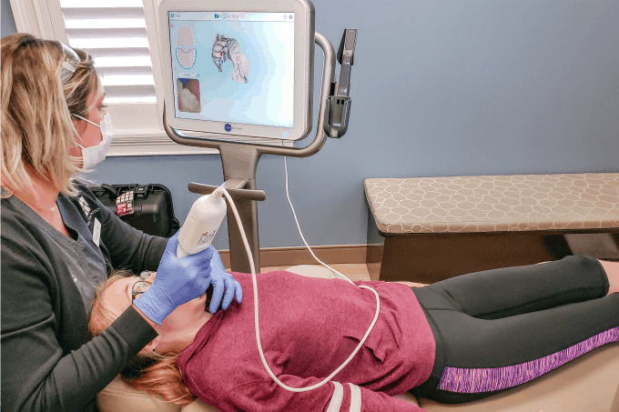Scanning teeth for Invisalign treatment with iTero